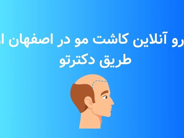 شروع شد! رزرو آنلاین نوبت کلینیک کاشت مو در اصفهان از طریق دکترتو