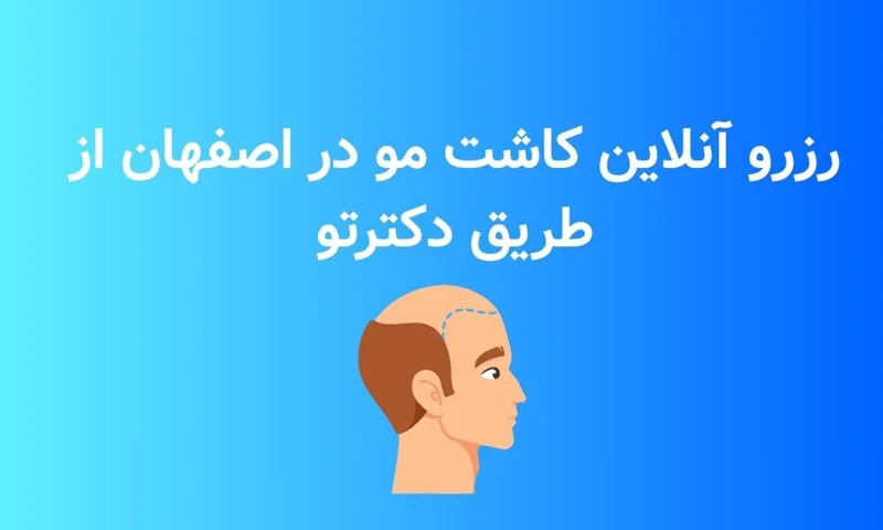 شروع شد! رزرو آنلاین نوبت کلینیک کاشت مو در اصفهان از طریق دکترتو
